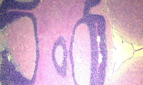 病理切片制作技术的基本方法