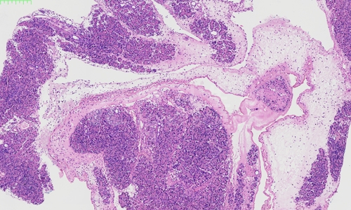 HE病理分析：病理学诊断中的关键技术