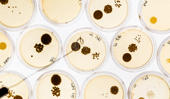 细菌培养实验服务